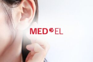 メドエルジャパン株式会社とは？人工内耳事業の強み、採用情報を紹介